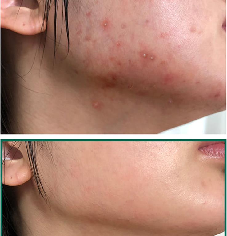 Gentle Nourishing Calming Recovery Essence