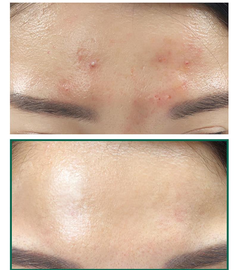 Gentle Nourishing Calming Recovery Essence